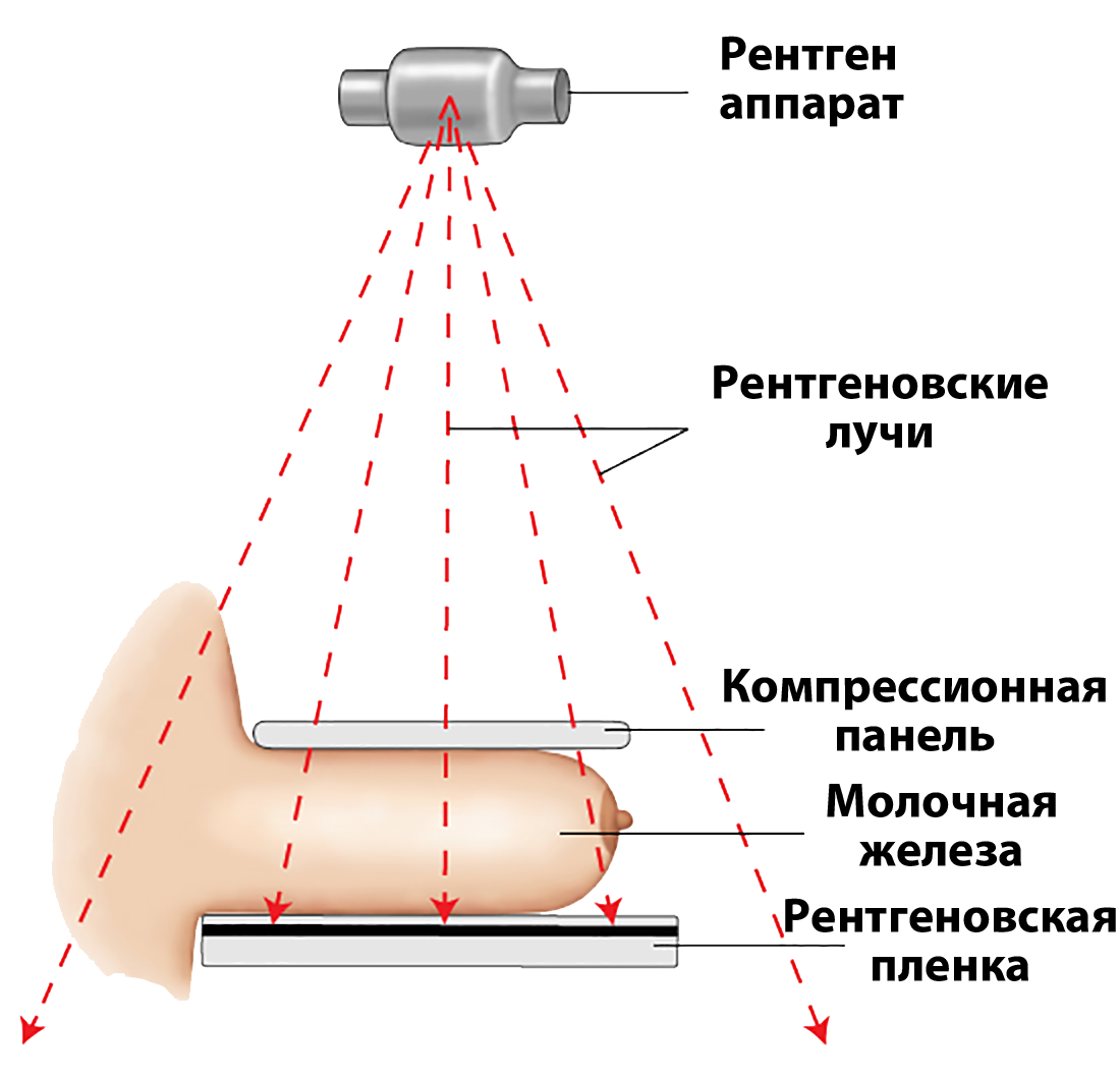 схема маммографии, маммография