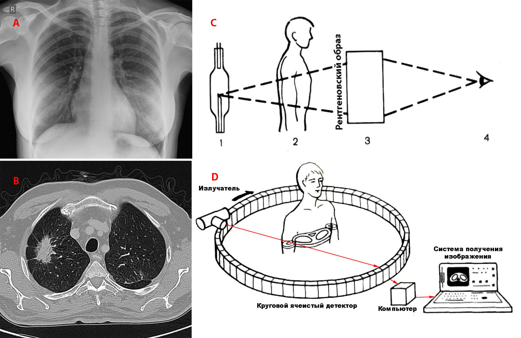 компьютерная томография схема