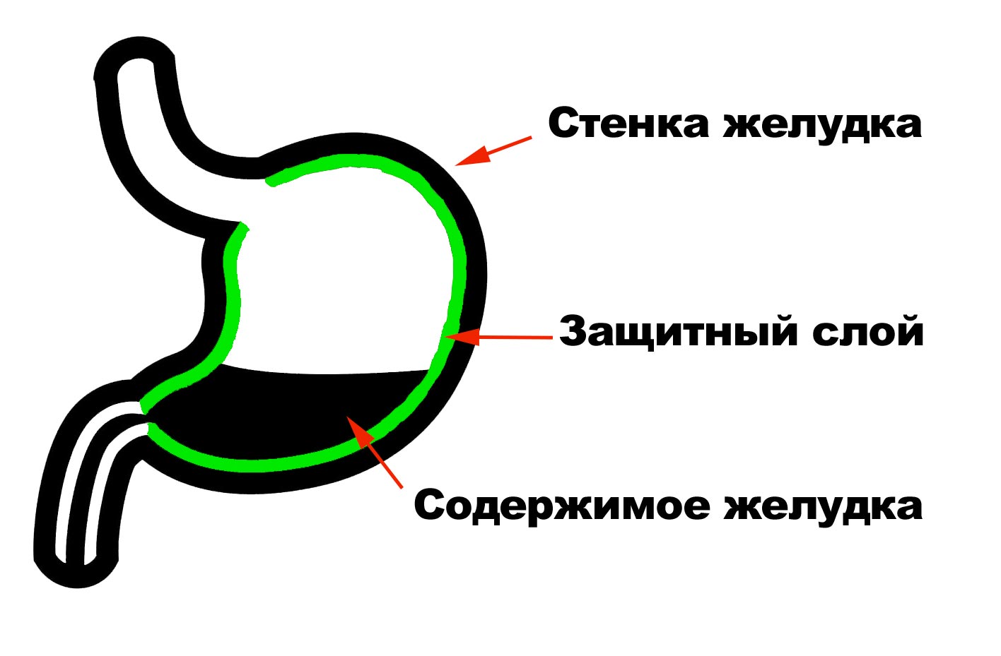 желудок, НПВС, аспирин, язвенная болезнь желудка и двенадцатиперстной кишки