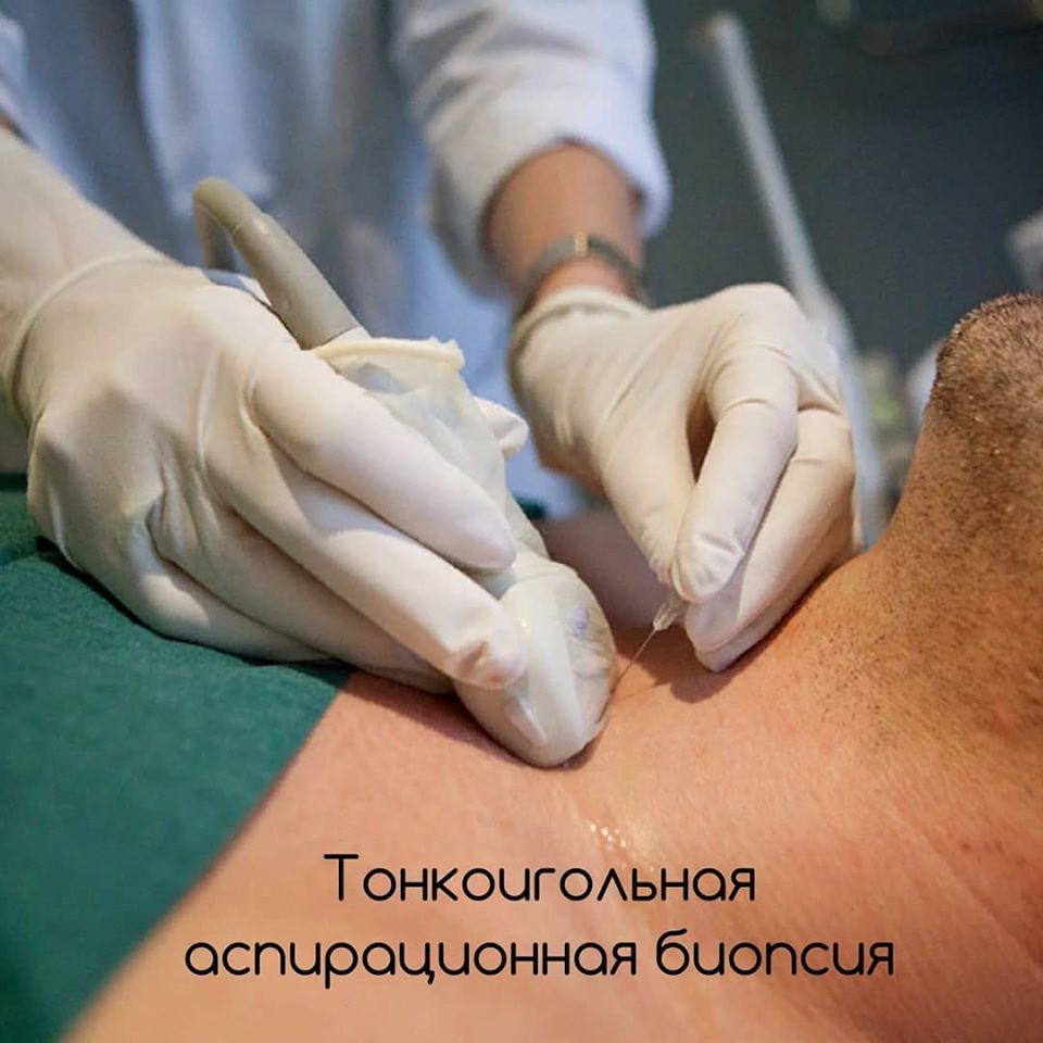 биопсия биопсия