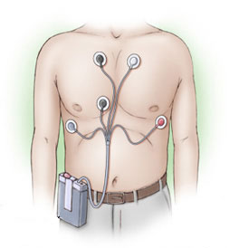 холтер, холтеровский мониторинг, холтеровский мониторинг ЭКГ, суточный мониторинг ЭКГ, длительный мониторинг ЭКГ