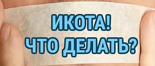 Икота. Общие сведения.