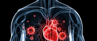 Профилактика инфекционного эндокардита. Информация для пациентов.