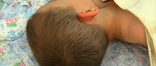 Основные причины травм головы у детей