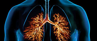 Бронхит. Информация для пациентов