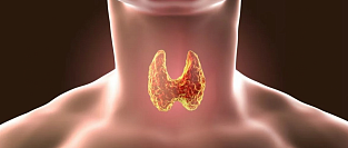 Рак щитовидной железы. Проблема гипердиагностики