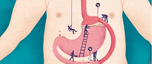 Бариатрическая хирургия и риск развития сахарного диабета