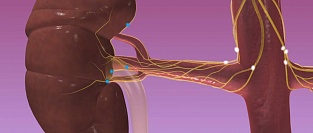 О денервации почечных артерий