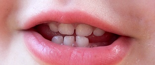 Руководство по уходу за полостью рта у младенцев