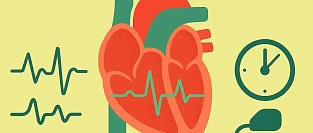 Что выбрать при мерцательной аритмии: восстановить ритм или контролировать частоту?