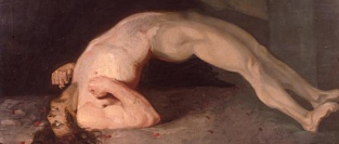 Столбняк. Клиника, диагностика, лечение, профилактика