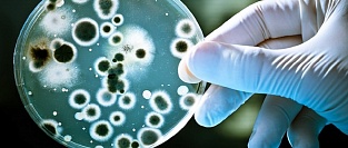 Европейские эпидемиологи предупреждаю о «супермикробах»
