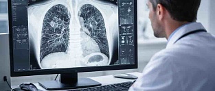 КТ при стабильной ХОБЛ. От скрининга рака до этиотипирования