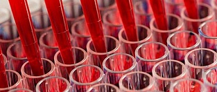 ixCELL-DCM: Стволовые клетки при ишемической кардиомиопатии