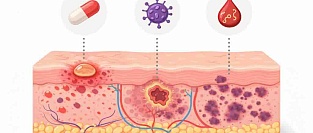 Неотложные дерматологические состояния: клинические ориентиры для практикующего врача