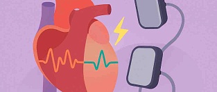 Электроимпульсная терапия (ЭИТ): как проходит, больно ли, зачем нужна