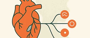 ОКС у молодых женщин: более половины случаев имеют неатеросклеротическую природу