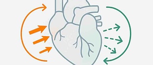 Систолическая и диастолическая дисфункция: в чём разница? Просто о сложном
