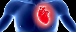 Инфаркт миокарда 2 типа. Опасность и встречаемость