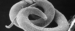 Шистосомоз и нейрошистосомоз