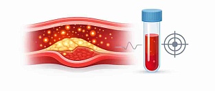 Воспаление как фактор сердечно-сосудистого риска. Позиция ACC 2026