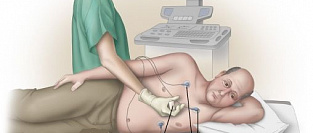 УЗИ сердца. Информация для пациентов.