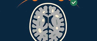 Обновленные международные критерии диагностики сосудистых когнитивных нарушений (VasCog-2-WSO)
