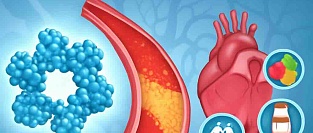 С-реактивный белок в оценке сердечно-сосудистых рисков. Заявление ACC 2025