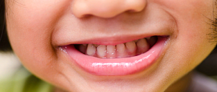 Прорезывание зубов у детей