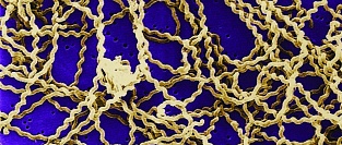 Лептоспироз