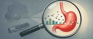 Связана ли ЗГТ с меньшим риском рака пищевода и желудка? Регистровые данные, которые не дают простого ответа