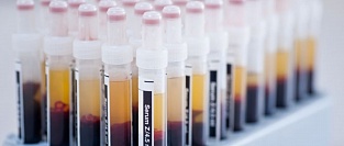 Совместные рекомендации ESC/EAS по лечению дислипидемий 2016