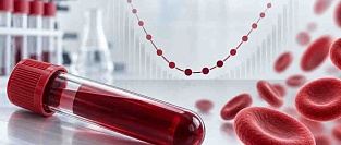 Норма гемоглобина и смертность. Результаты исследования UK Biobank