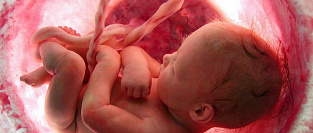 Уход за пупком младенца