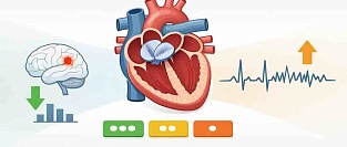 Шкала PASCAL в принятии решения о закрытии ООО после криптогенного инсульта