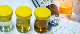 USPSTF о скрининге бессимптомной бактериурии у беременных