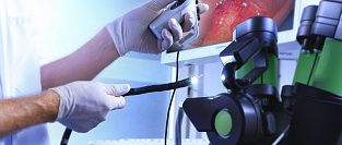 О безопасности эндоскопии в раннем постинфарктном периоде